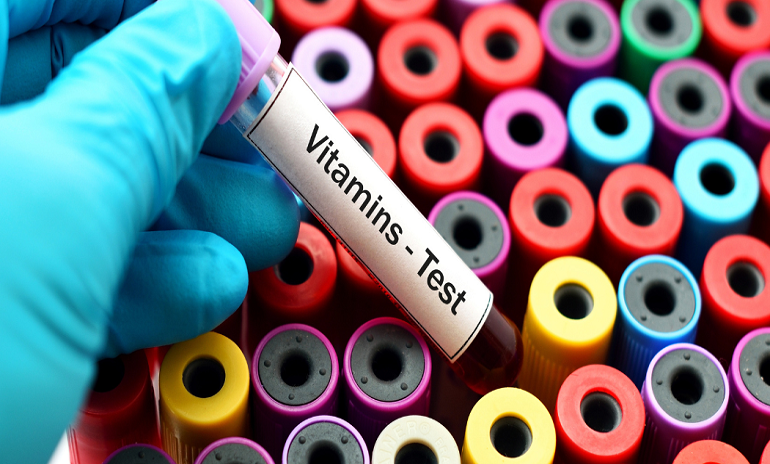 Vitamin Tests