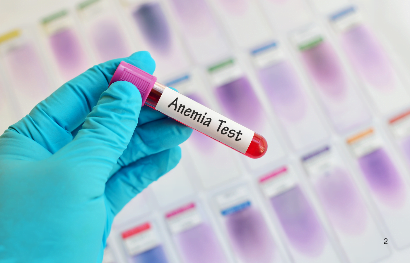Anemia Tests